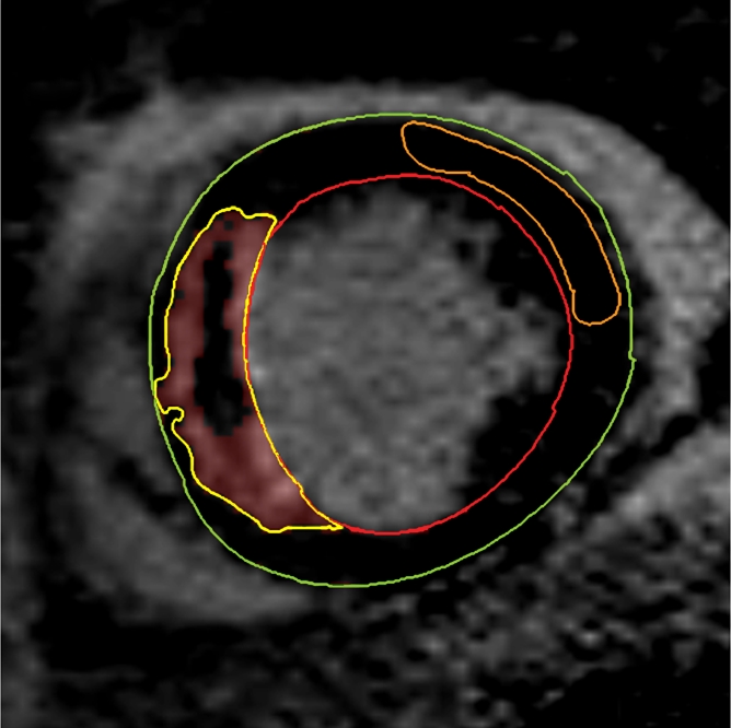 Figure 1c: