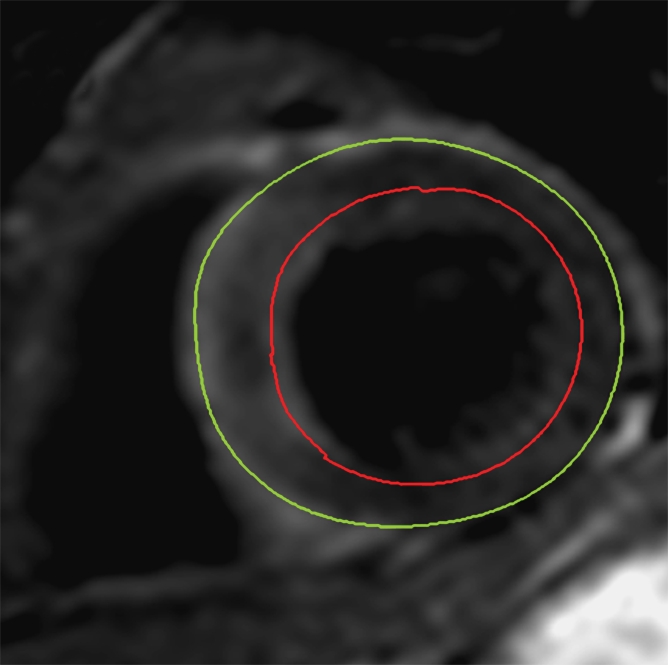 Figure 2a: