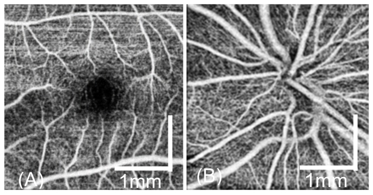 Fig. 11