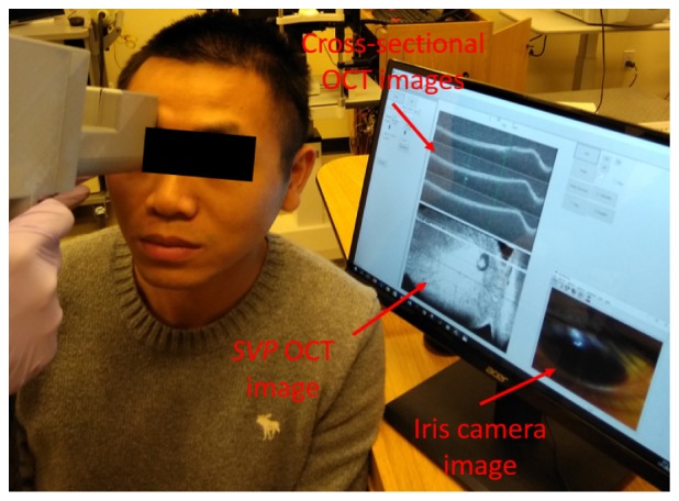 Fig. 3