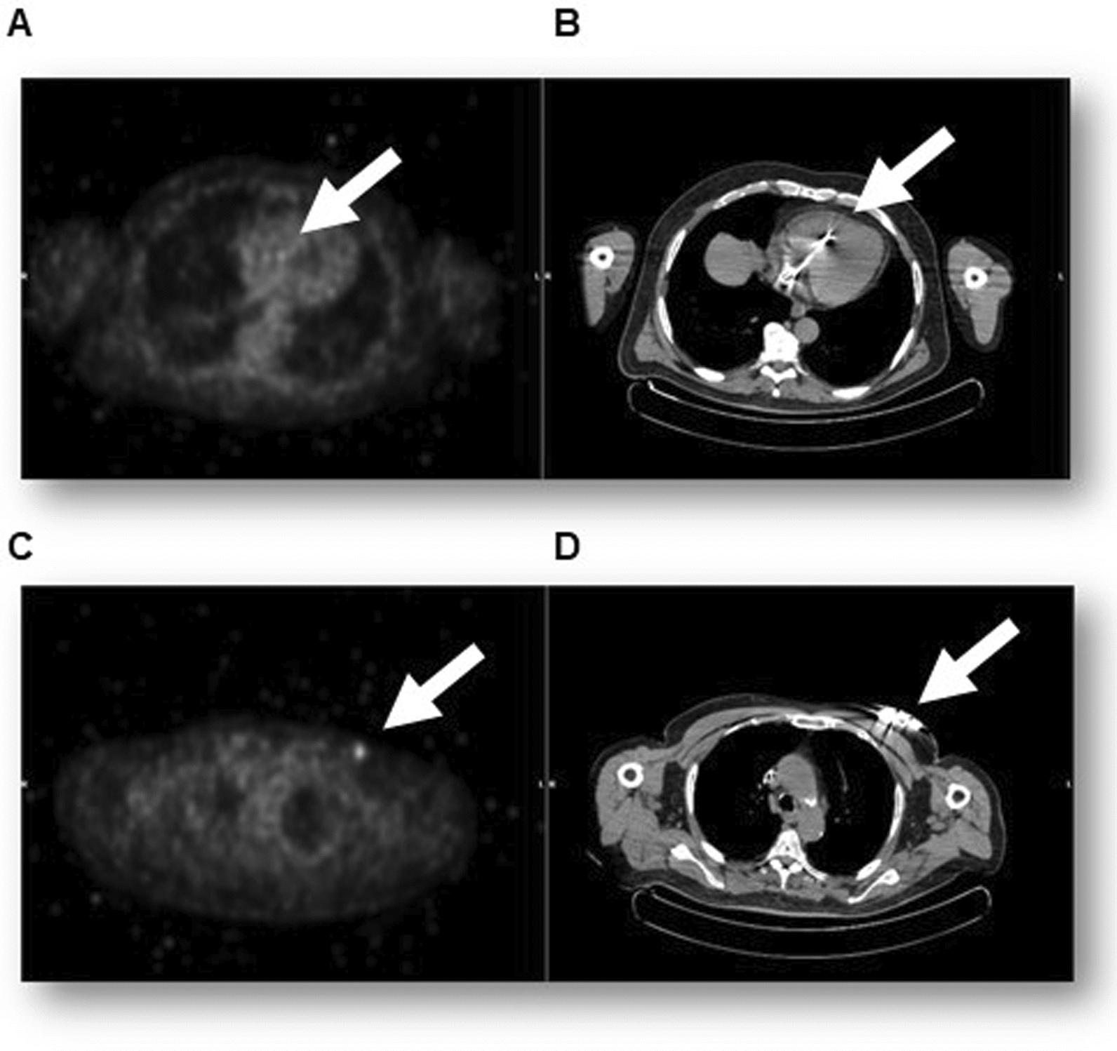 Fig. 1