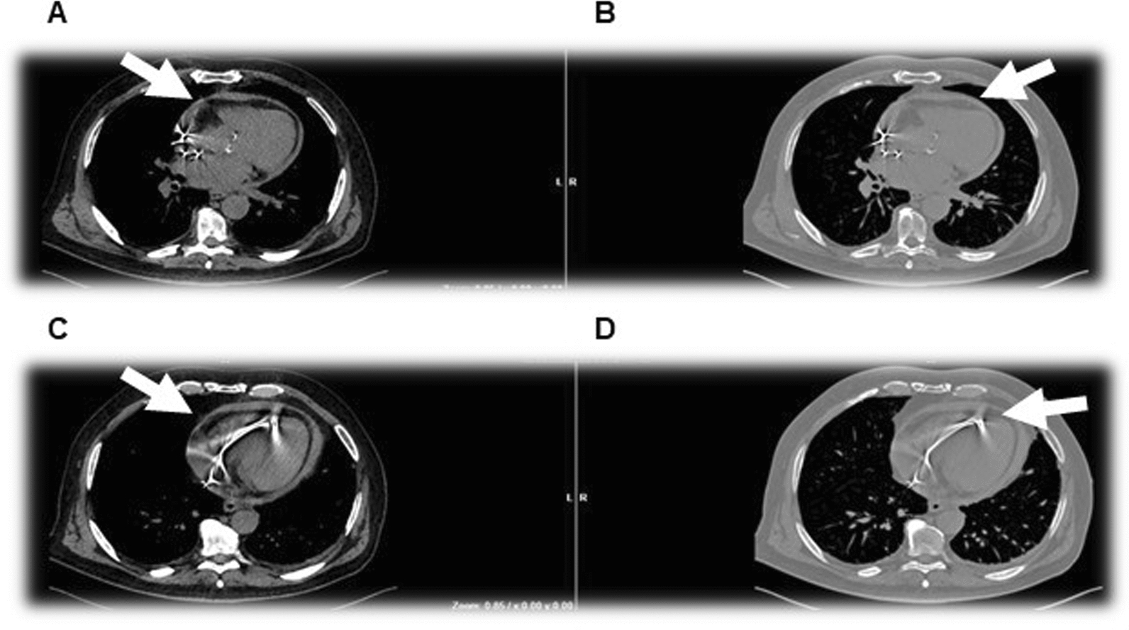 Fig. 3