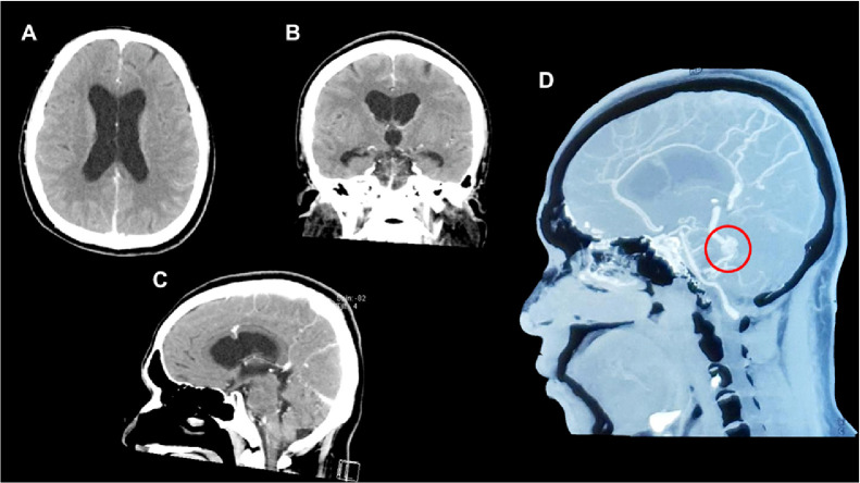 Fig. 1 –