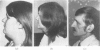 252