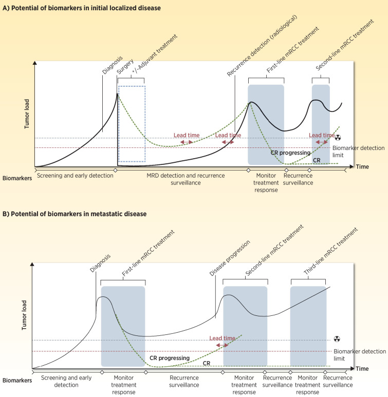 Figure 2. Illustration of a standard disease course for (A) localized to metastatic disease and (B) for primary metastatic disease, highlighting the potential of biomarkers at the various steps. Detection limits for both radiologic assessments and potential biomarkers are indicated. Lead time indicates the time from detection of residual disease/relapse/disease progression by use of a biomarker to the time for which the residual disease/relapse/disease progression can be detected by current standard CT scans. The radiation symbol denotes imaging. (Adapted from an image created with BioRender.com.)