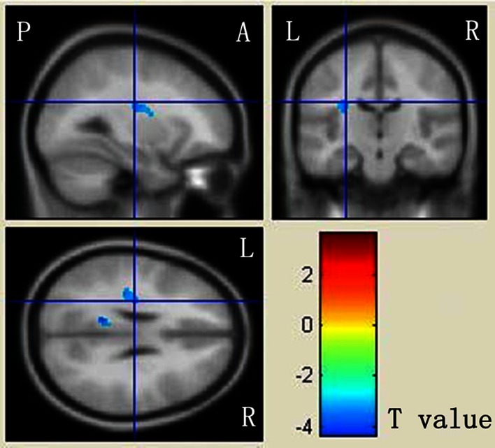 Fig. 3