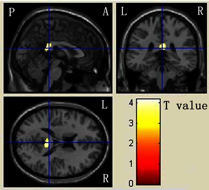 Fig. 2