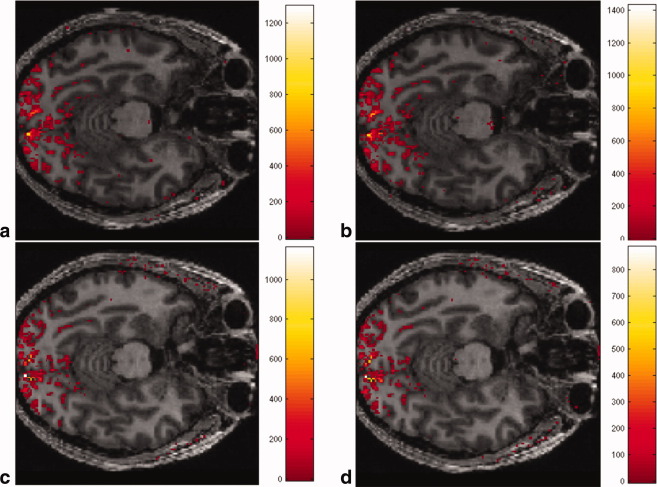 FIG. 4