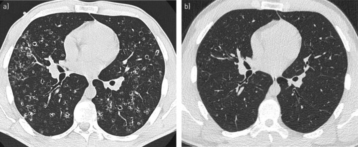 FIGURE 1