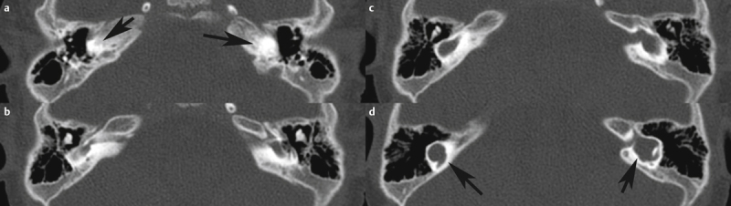 Fig. 9