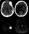 FIG 2.