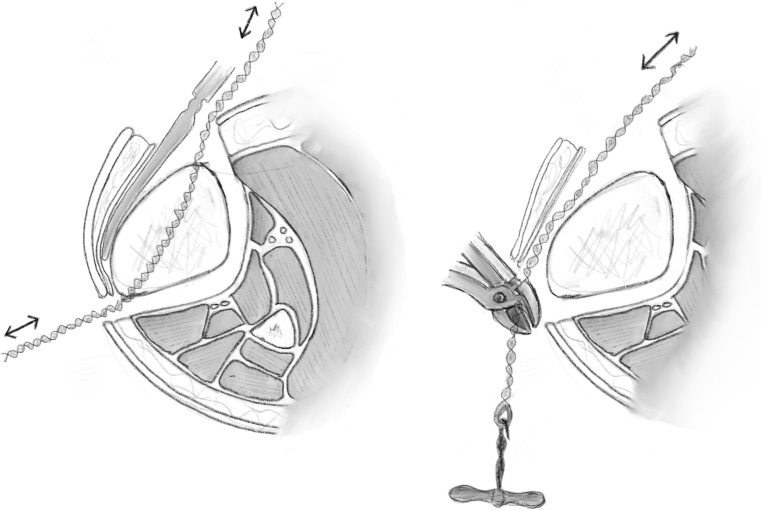 Fig. 10