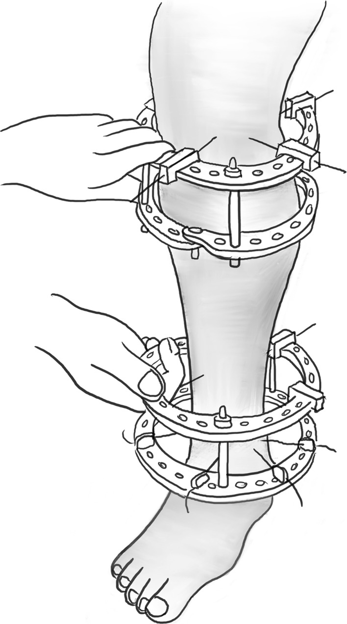 Fig. 2