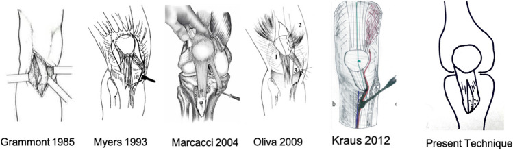 Fig. 1