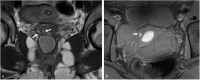 Fig 4 –