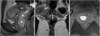 Fig 2 –