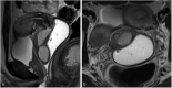 Fig 3 –