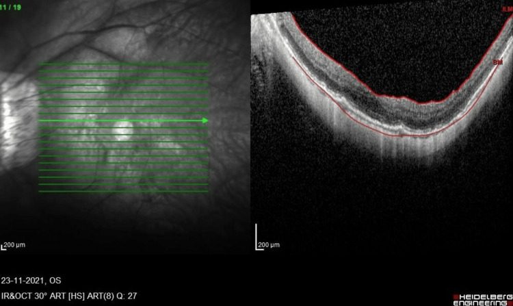 Figure 6