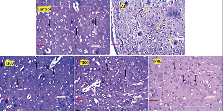 Figure-5