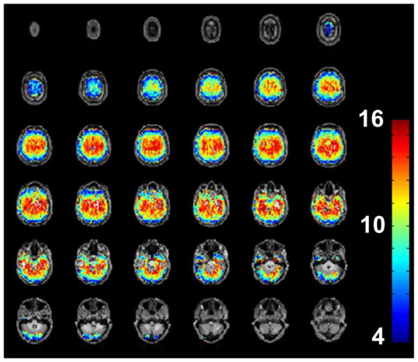 Figure 13