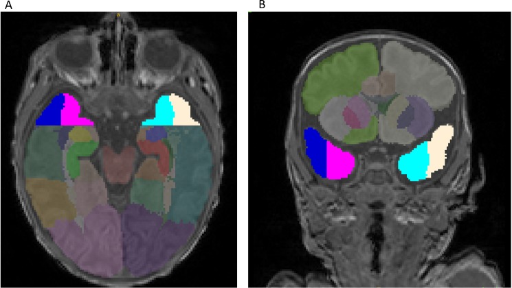 Fig 2