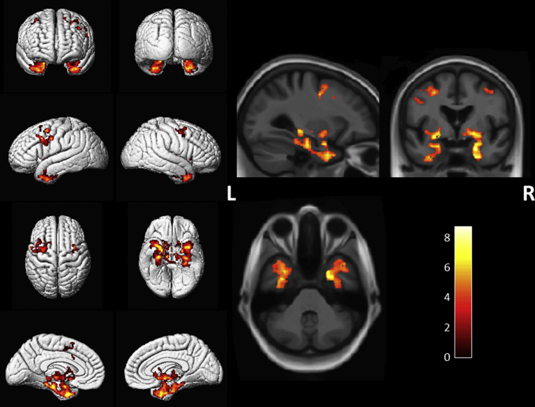 Fig. 2