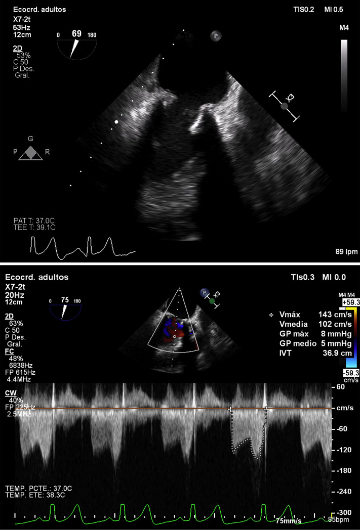 Figure 2