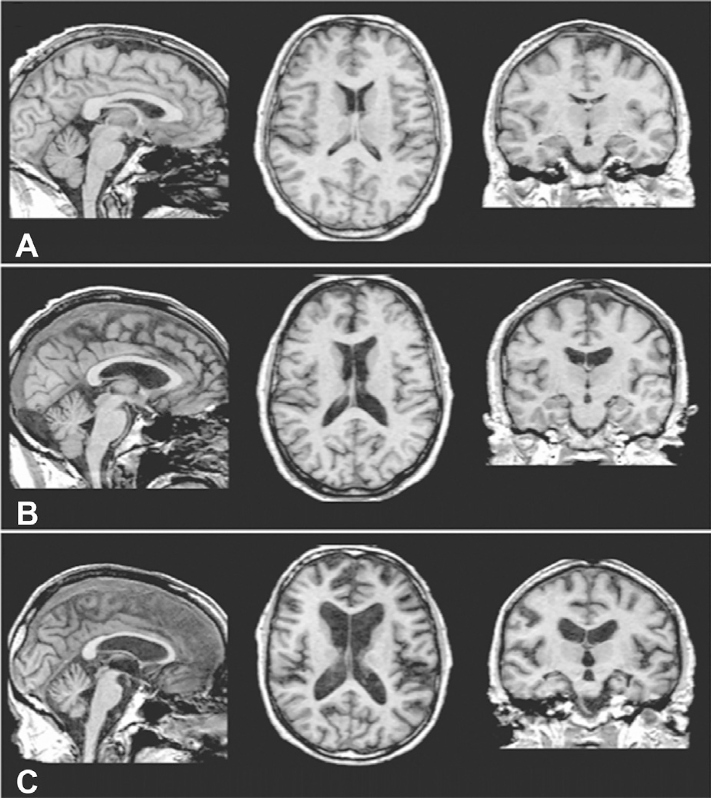 Fig. 17.5.