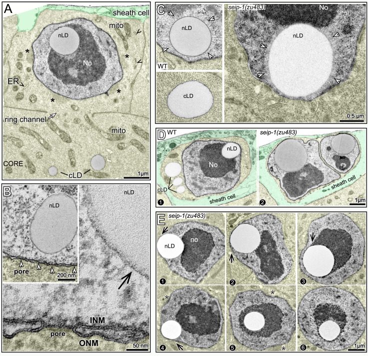 Fig 11