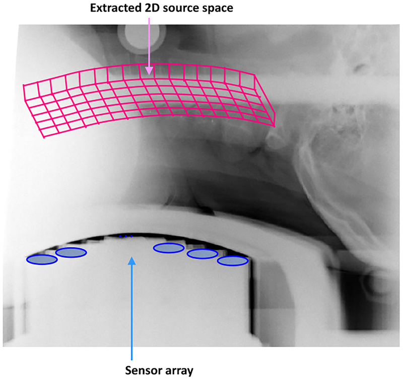 Figure 11: