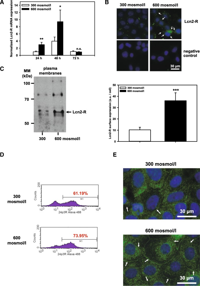 Tonicity inversely modulates lipocalin-2 (Lcn2/24p3/NGAL) receptor ...