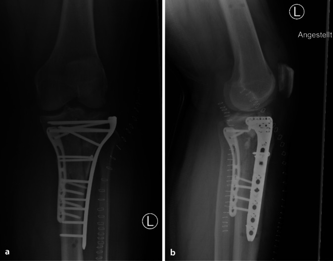 graphic file with name 113_2020_910_Fig5_HTML.jpg