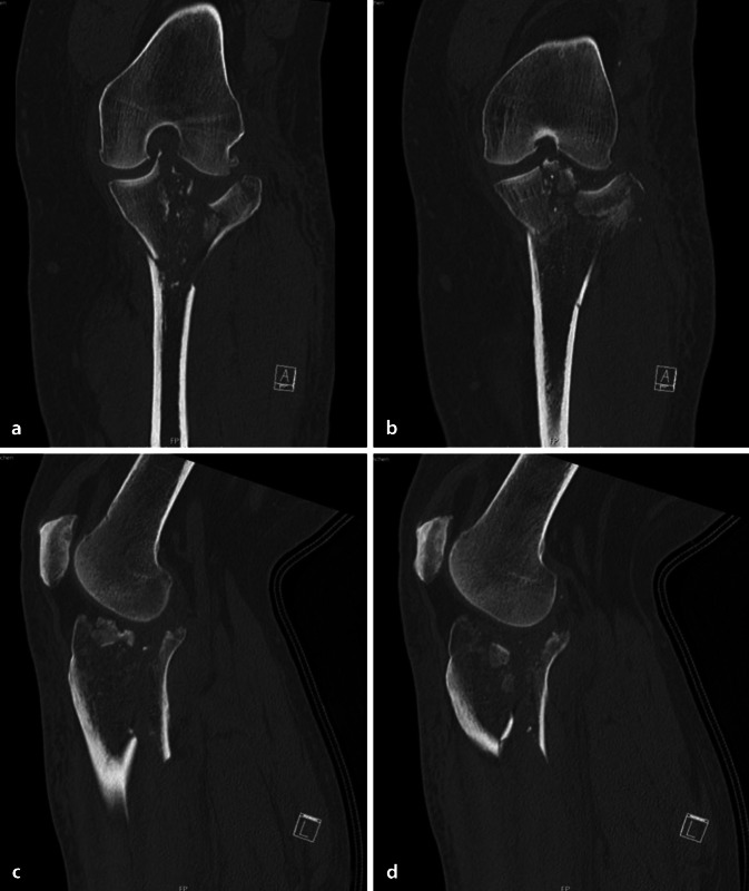 graphic file with name 113_2020_910_Fig4_HTML.jpg