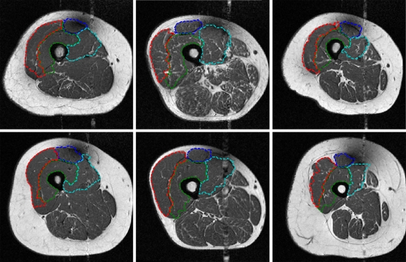 Fig 12