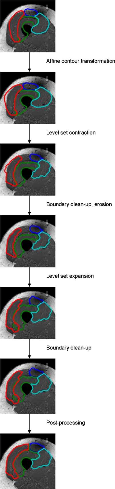 Fig 11