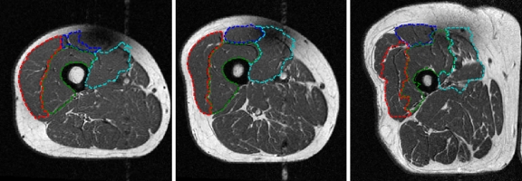 Fig. 14