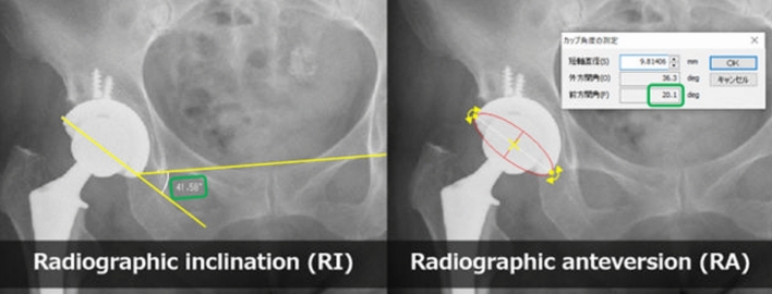 Figure 6