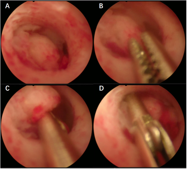 Figure 1