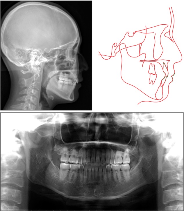 Figure 13