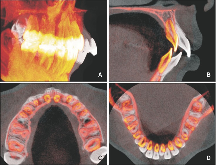 Figure 11