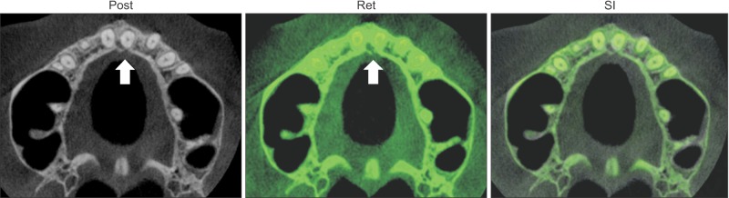 Figure 15