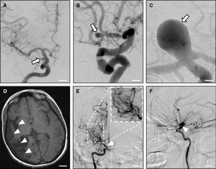 Fig. 2