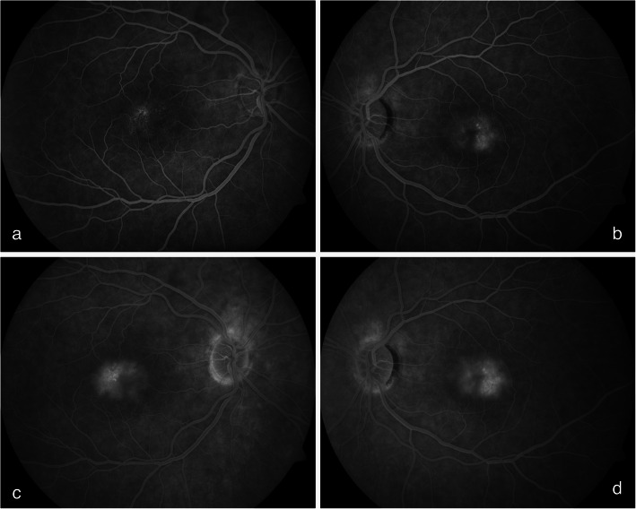 Fig. 2