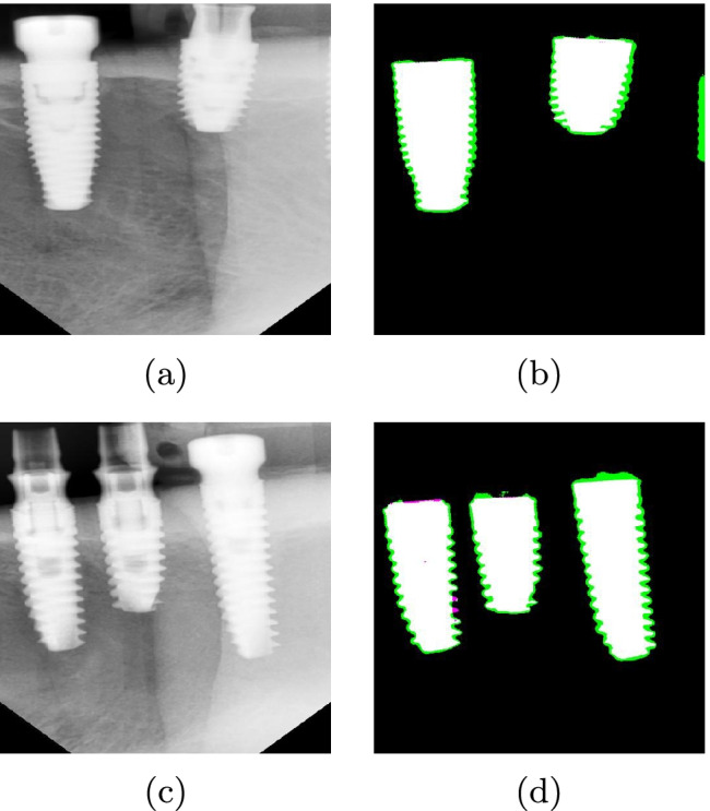 Fig. 16