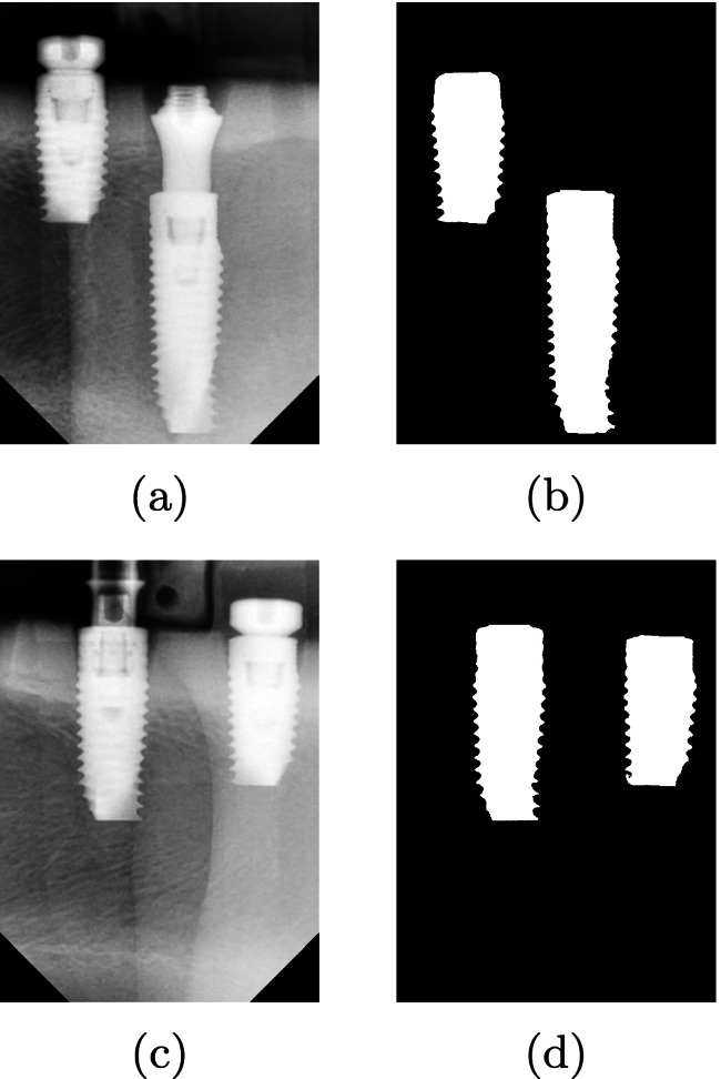 Fig. 11