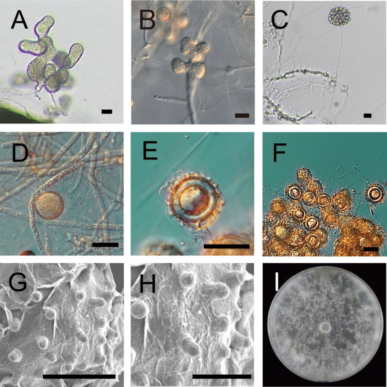 Fig. 2 Morphological characteristics of Pythium amaminum.