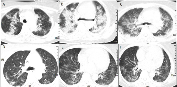 Fig. 2: