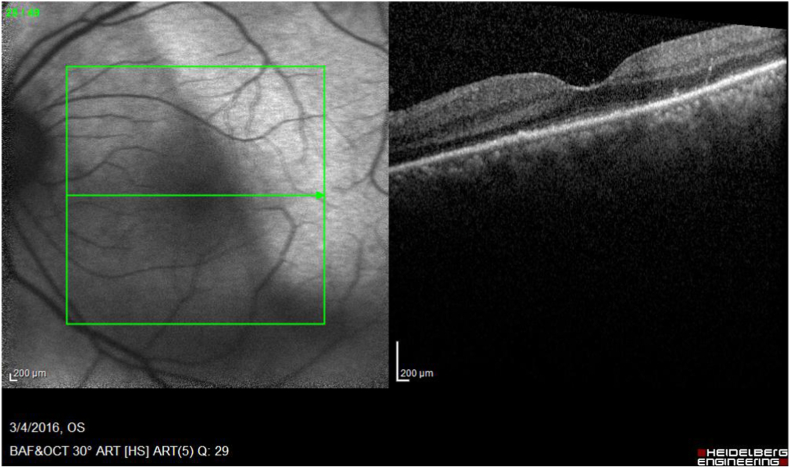 Fig. 1B