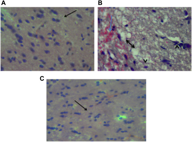 FIGURE 14