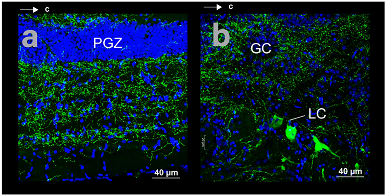 Figure 11: